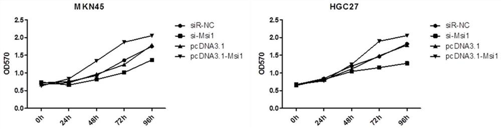 Application of Msi1 in preparation of gastric cancer treating preparation and prediction of tolerance of chemotherapy drug