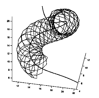 Intracranial aneurysm virtual intervention stent implantation method and device and computer device