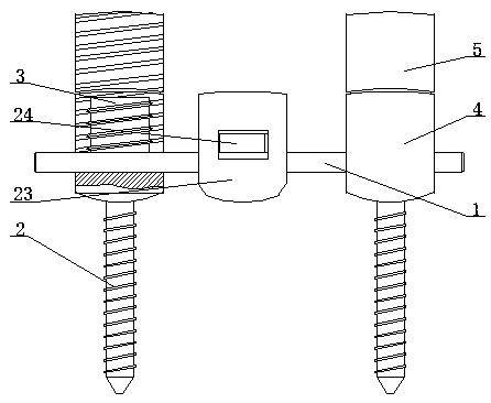 Loosening-preventing vertebral pedicle screw-rod system