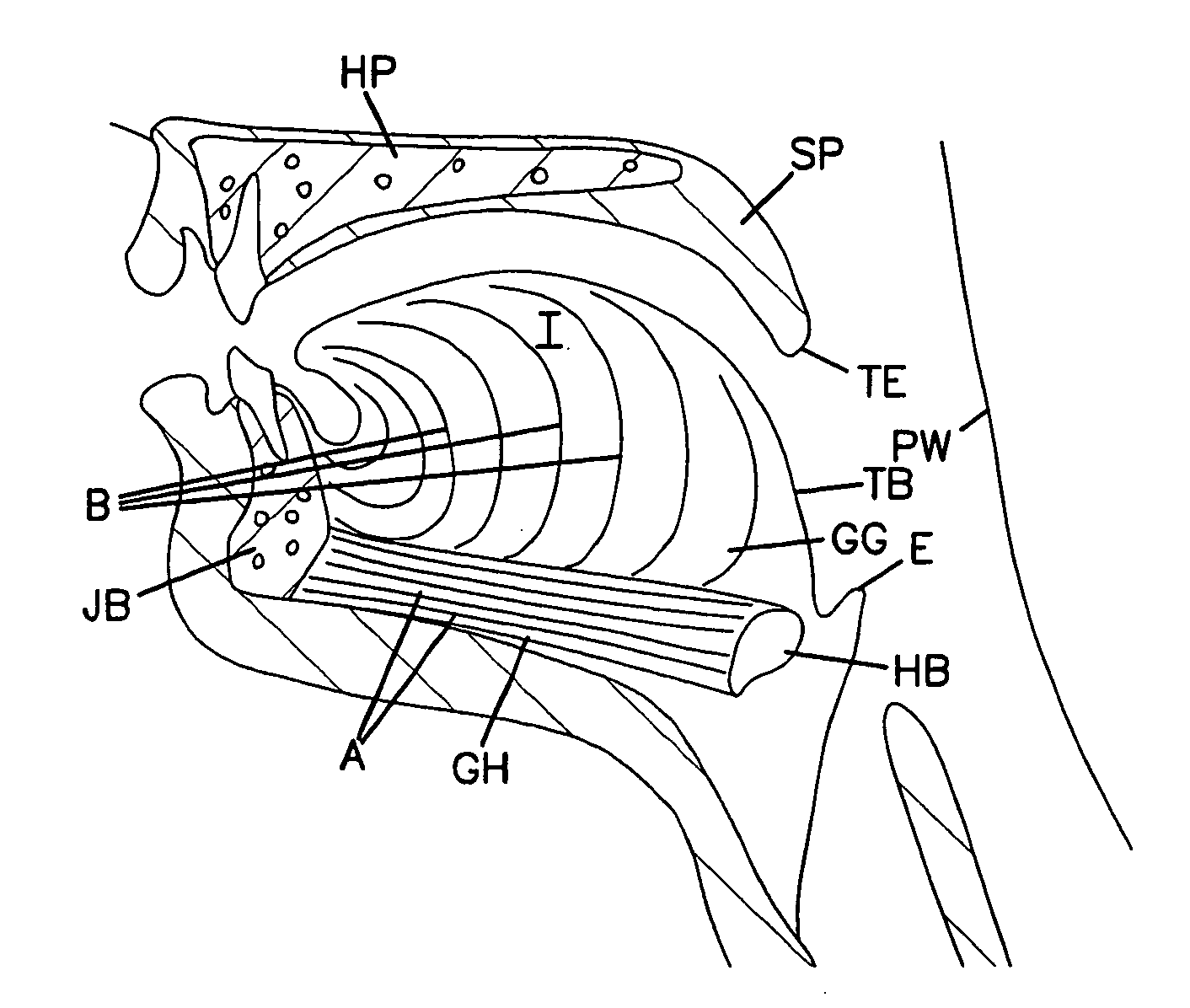 Tongue implant