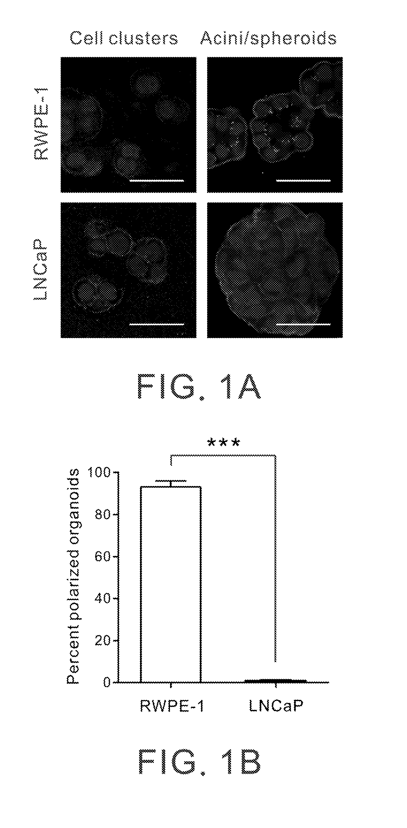 Molecular markers for prognostically predicting prostate cancer, method and kit thereof