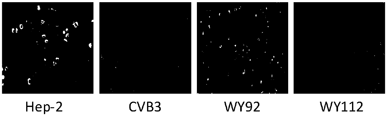 Application of nitrogen-containing heterocyclic aromatic ester compounds in the preparation of drugs against Coxsackie virus type b3