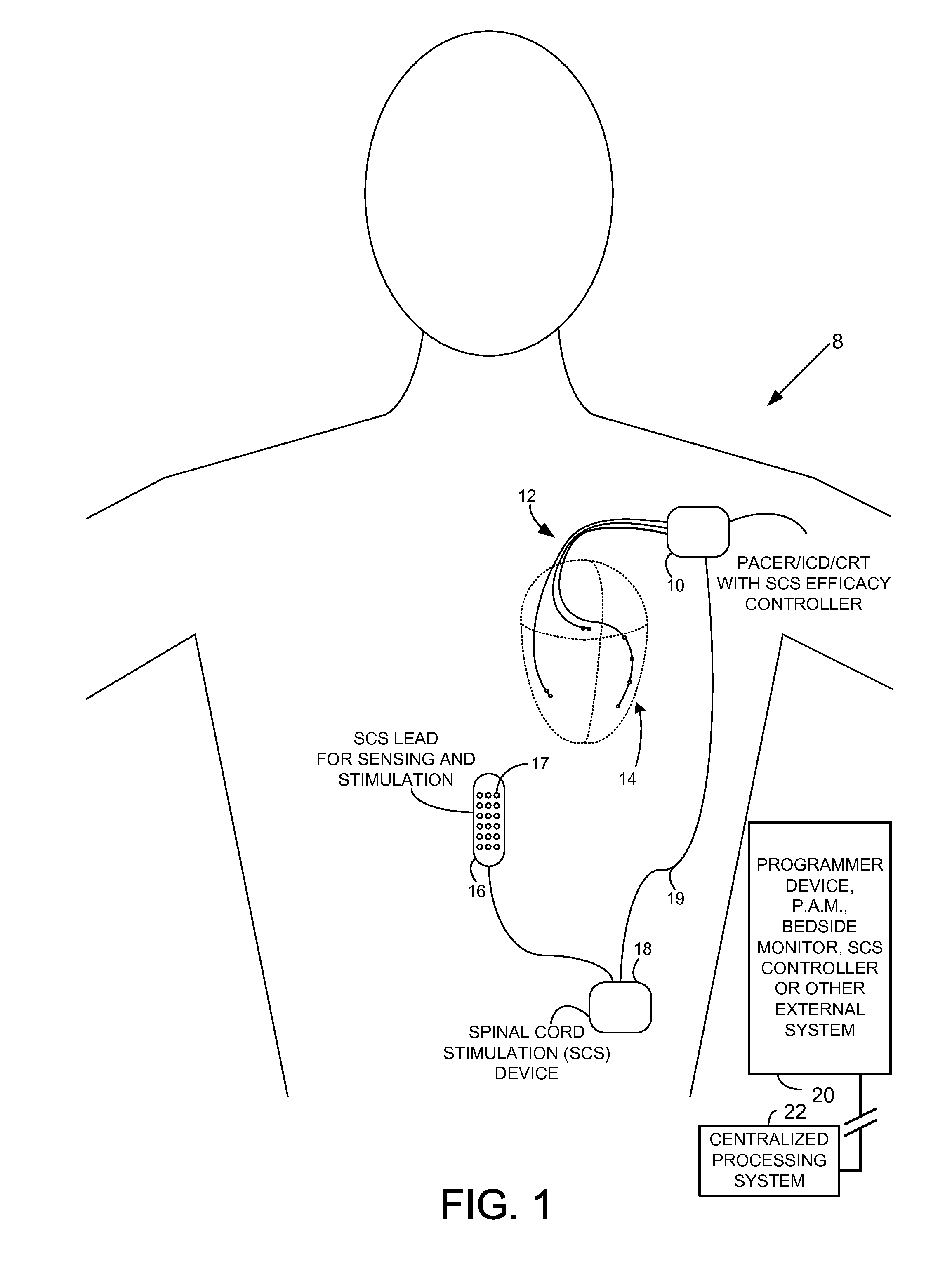 Systems and methods for controlling spinal cord stimulation to improve stimulation efficacy for use by implantable medical devices