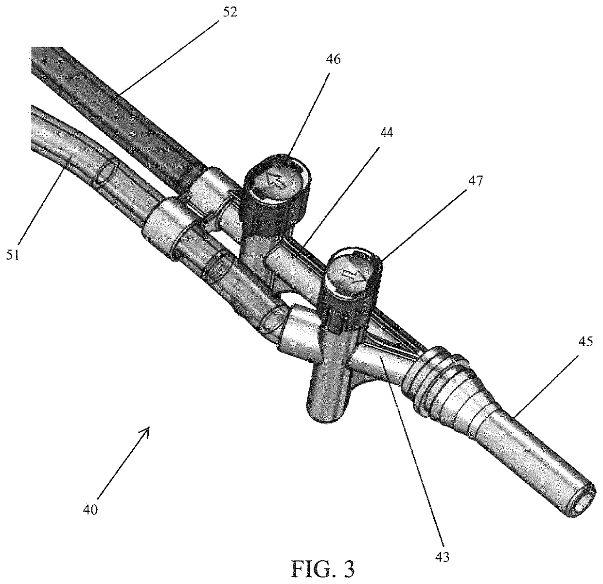 System for improving fluid drainage