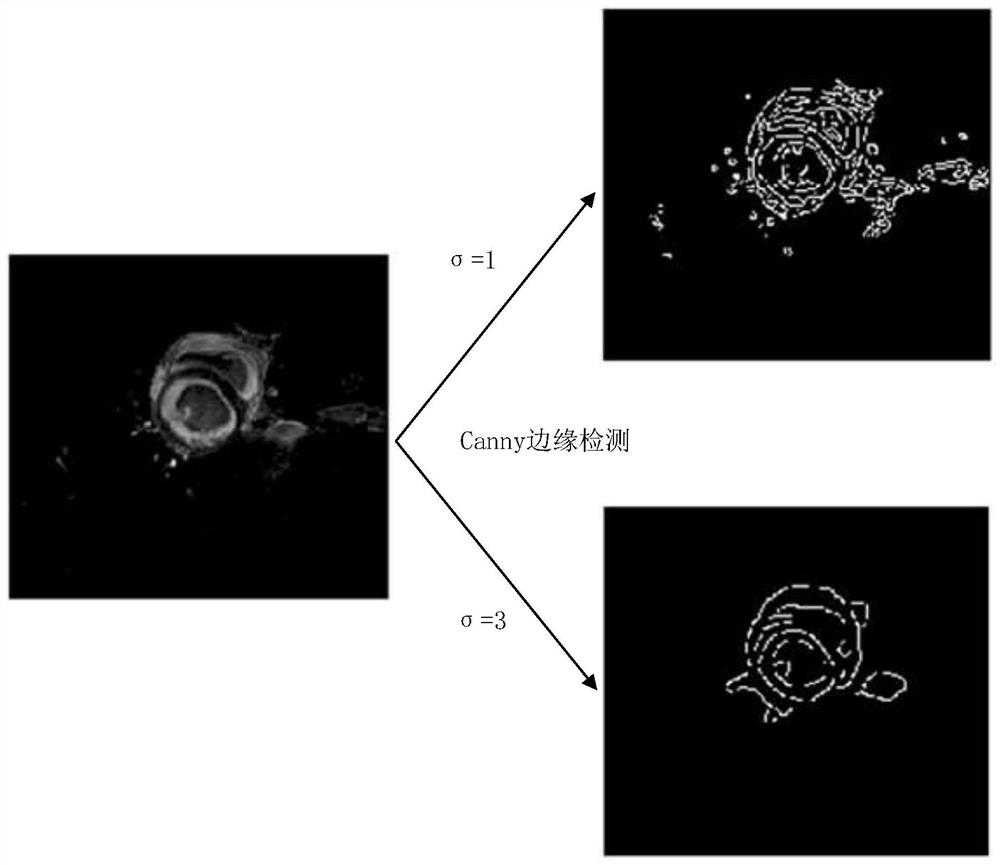 Heart segmentation model and pathological classification model training, heart segmentation and pathological classification method and device based on heart MRI (Magnetic Resonance Imaging)