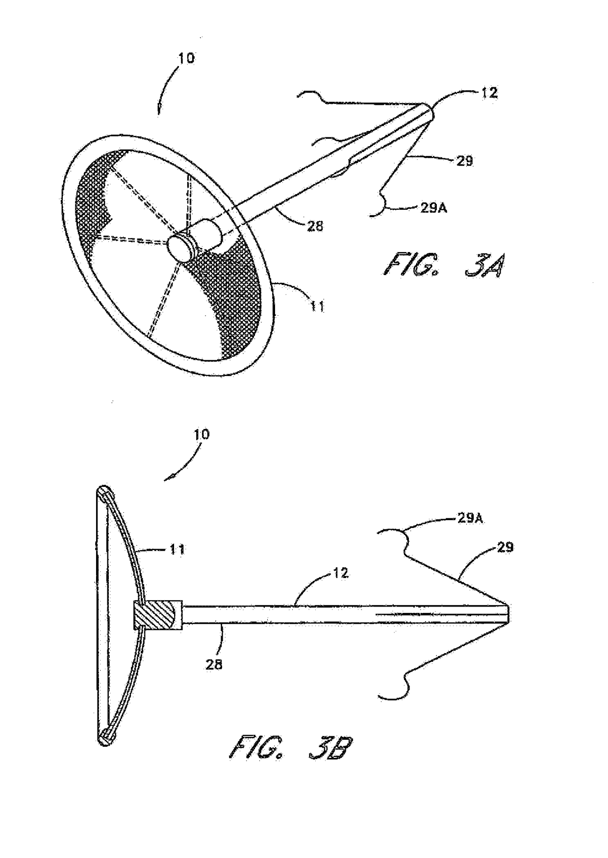 System for left atrial appendage occlusion