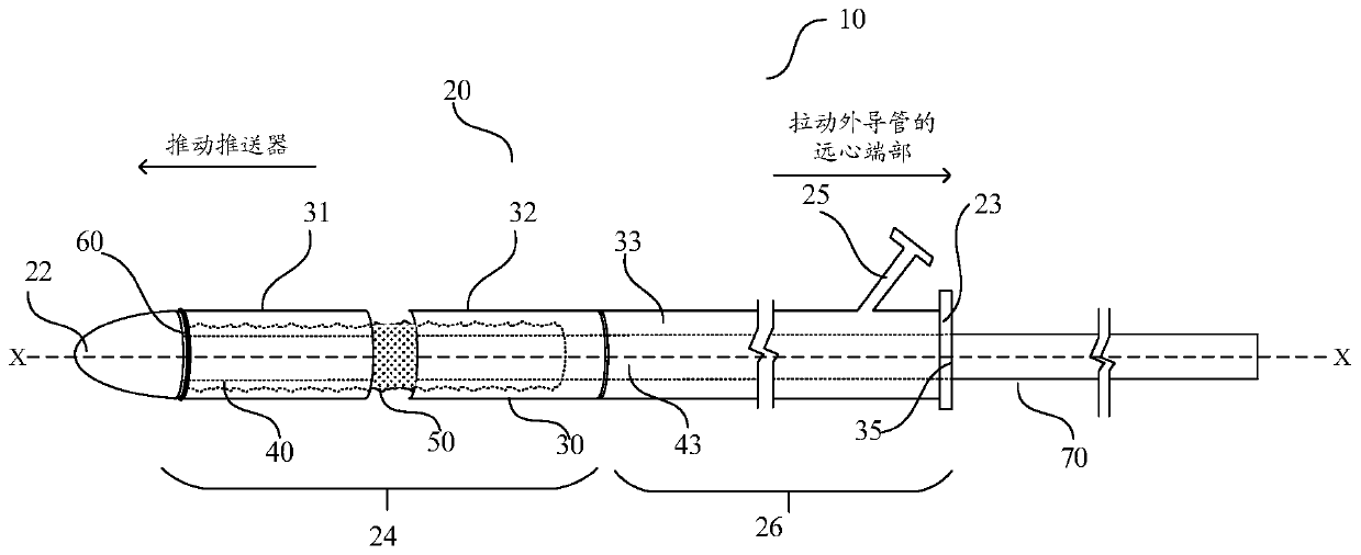 Brackets, bracket delivery system and kit