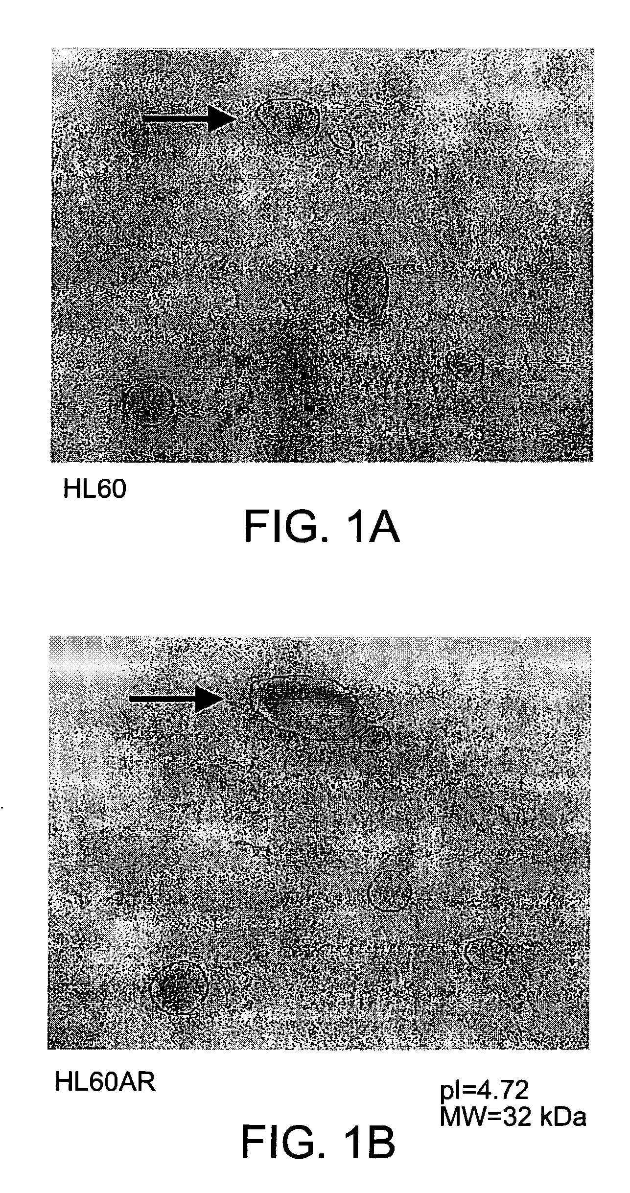 Nucleophosmin directed diagnostics and therapeutics for multidrug resistant neoplastic disease