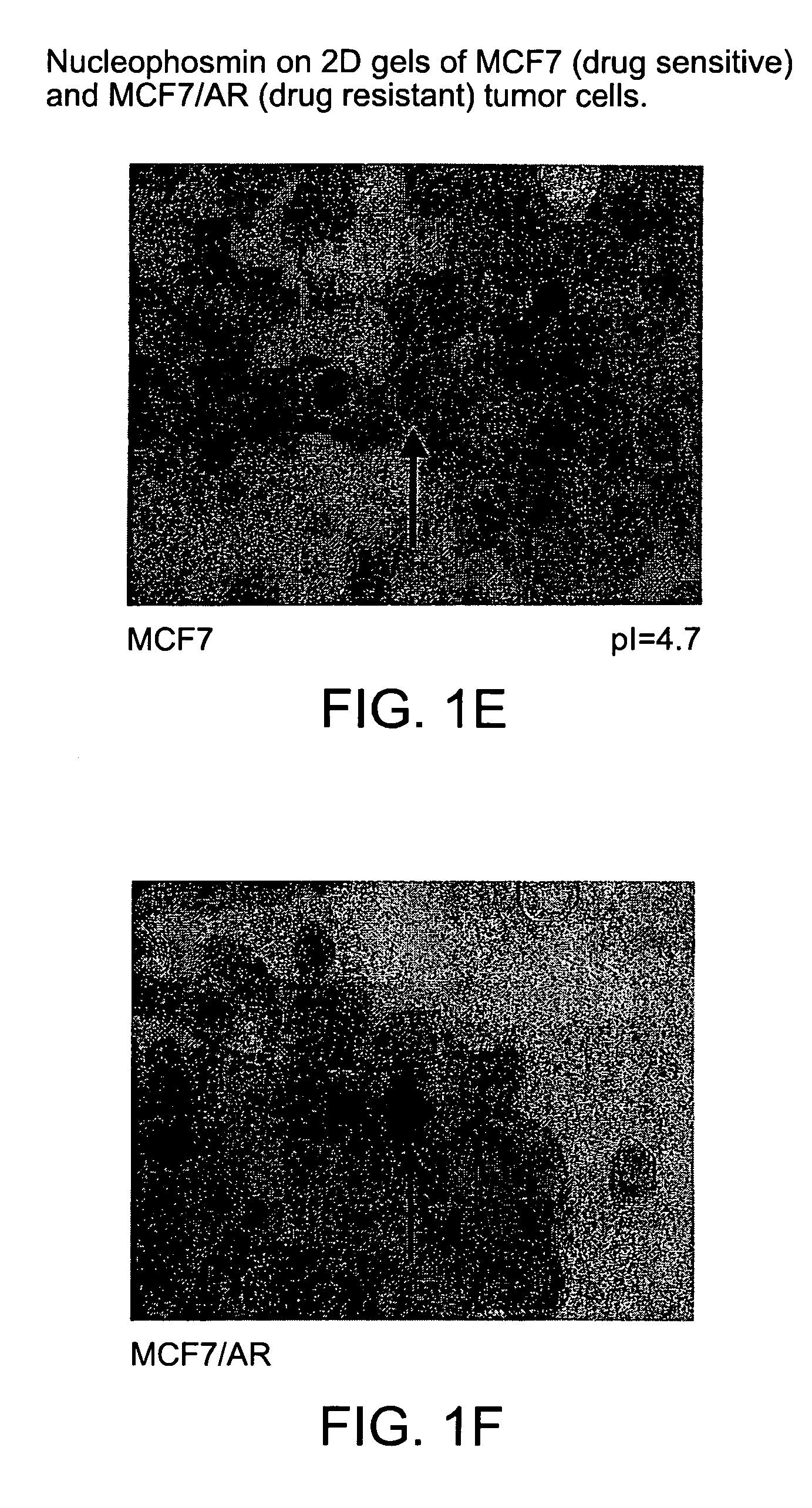 Nucleophosmin directed diagnostics and therapeutics for multidrug resistant neoplastic disease