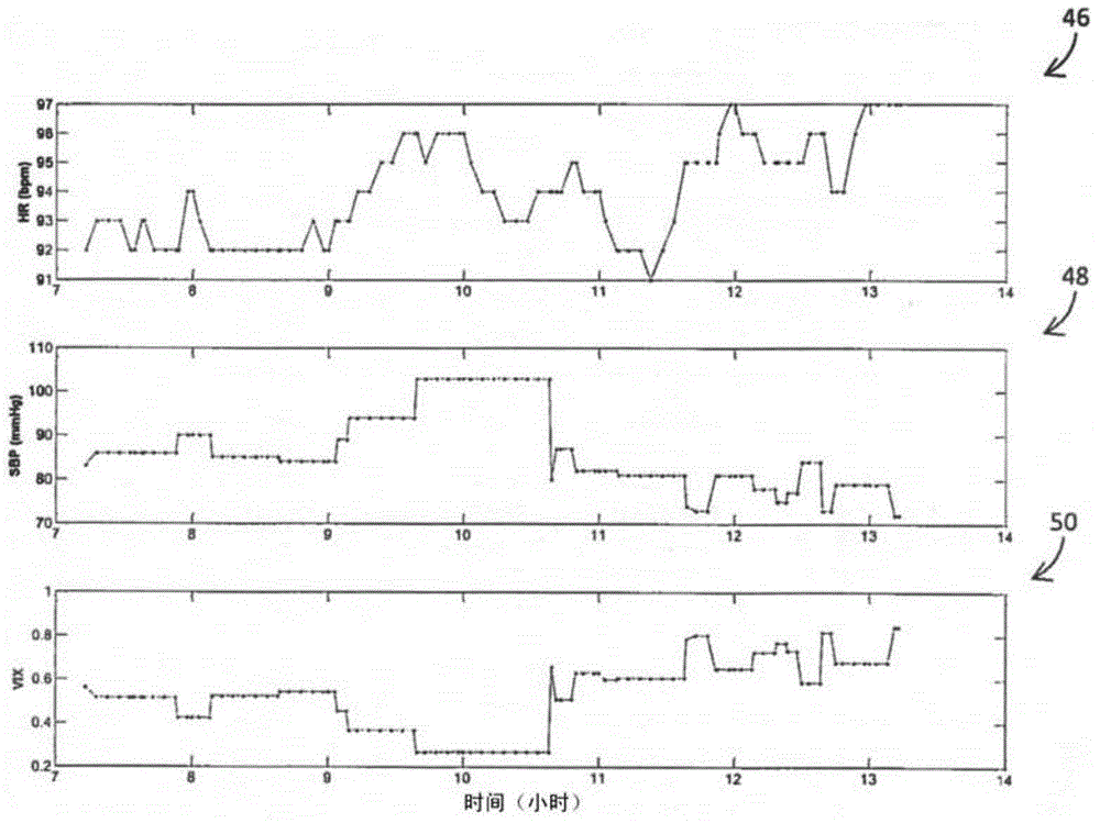 Method of rendering hemodynamic instability index indicator information