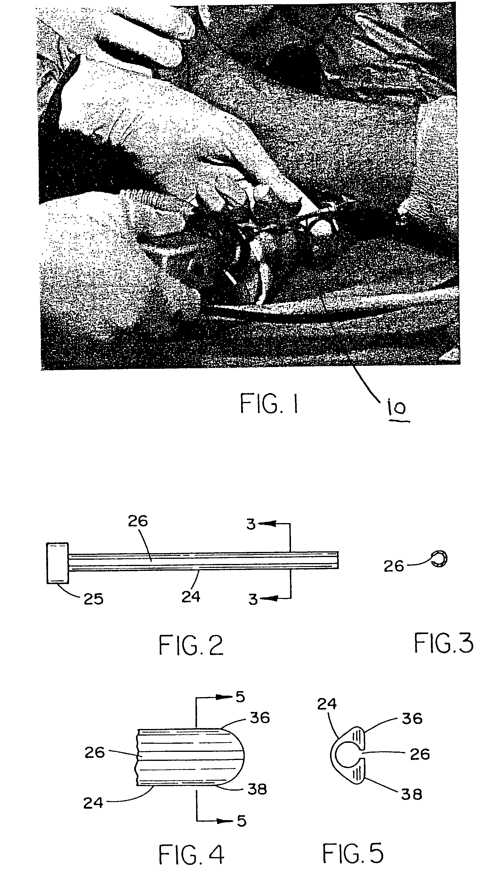 Endoscopic surgical procedure