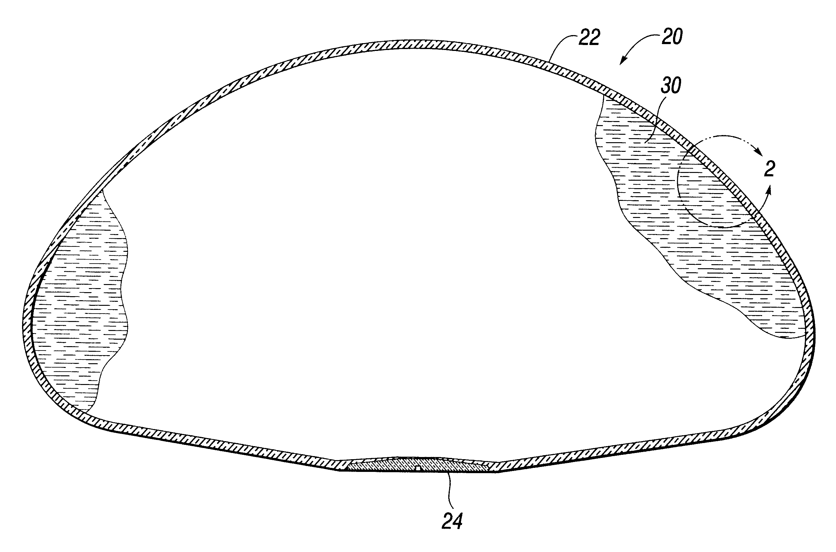 Self-sealing shell for inflatable prostheses