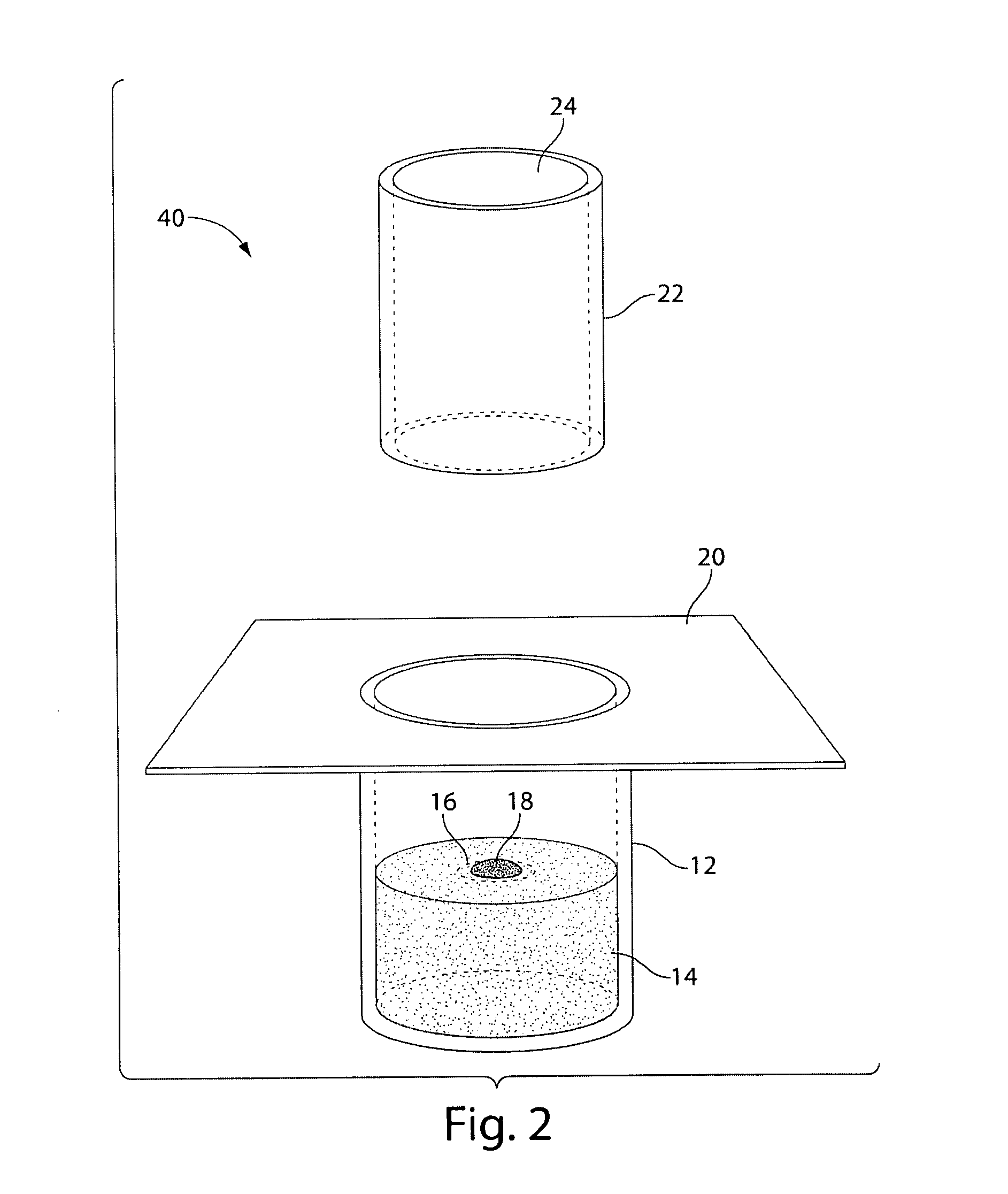 Bio-Matrix Stretcher