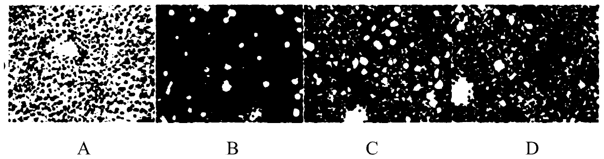 Traditional Chinese medicine composition for treating fatty liver