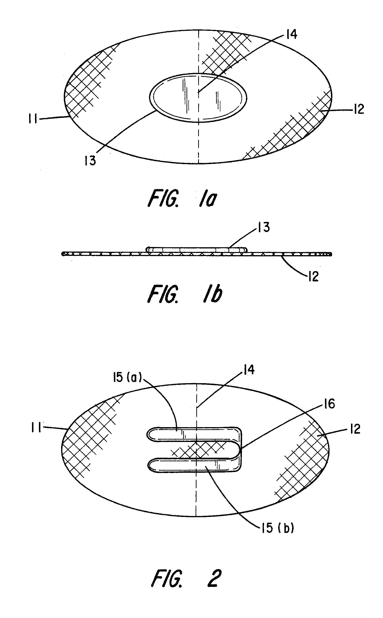 Partial cuff