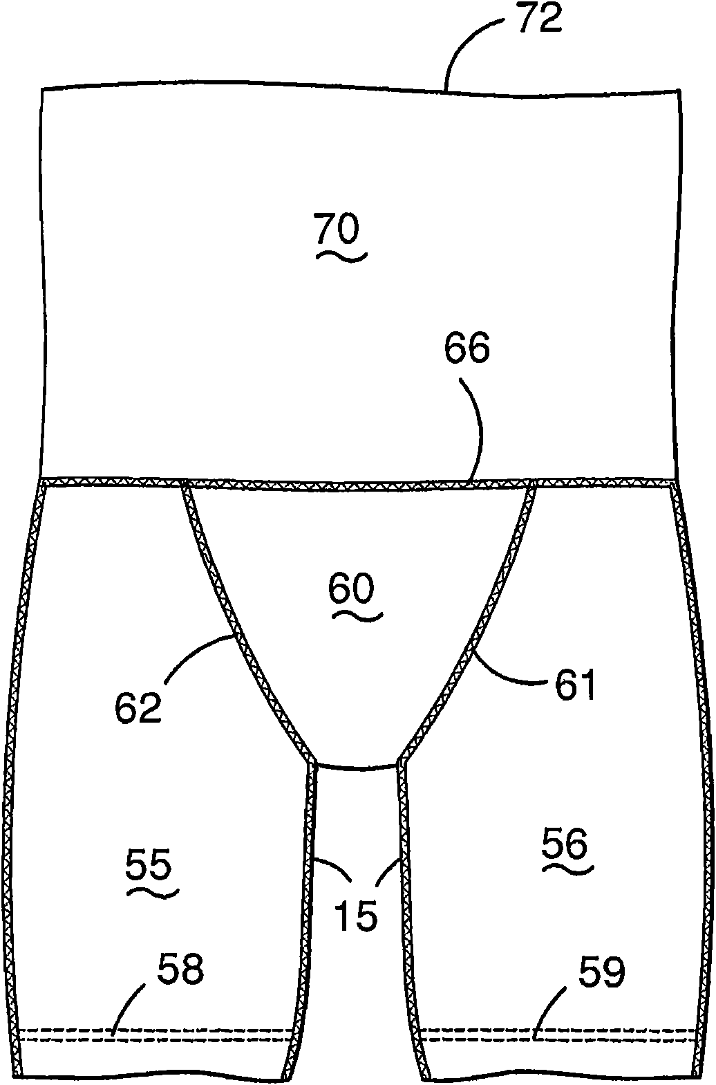 Compression garment