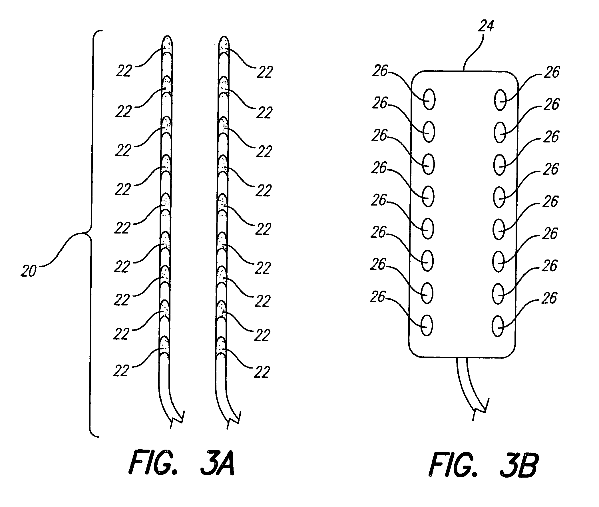 System and method of rapid, comfortable parameter switching in spinal cord stimulation