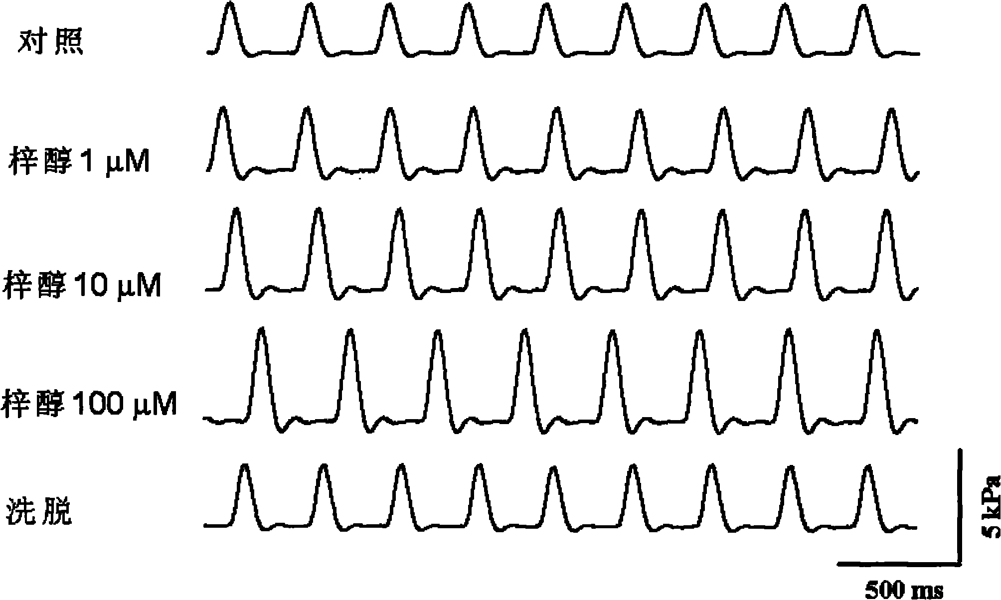 Application of catalpol in preparing drug for treating cardiac failure disease