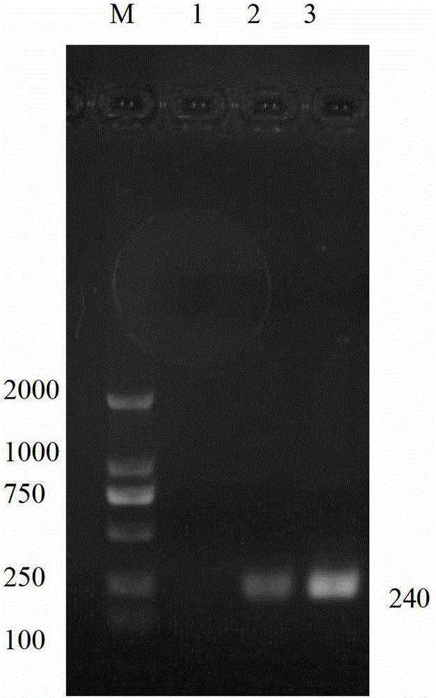 Rabbit hemorrhagic disease virus RT-PCR detection method