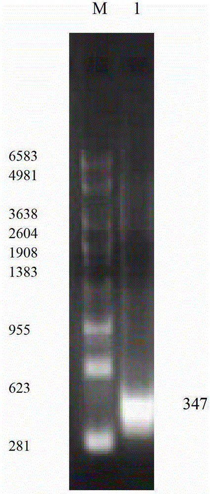 Rabbit hemorrhagic disease virus RT-PCR detection method