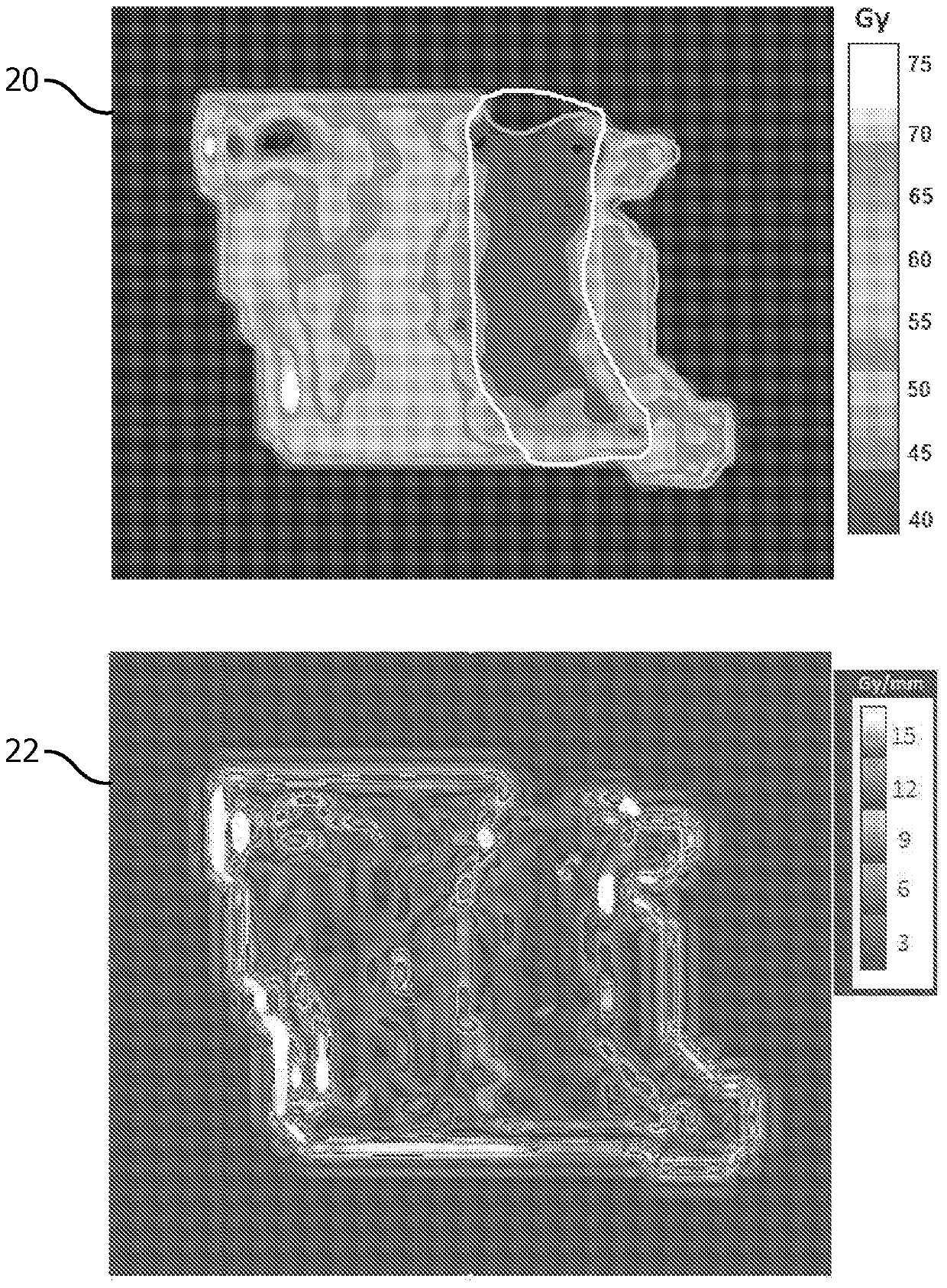 An interactive dose-gradient-based optimization technique for controlling the complexity of imrt delivery