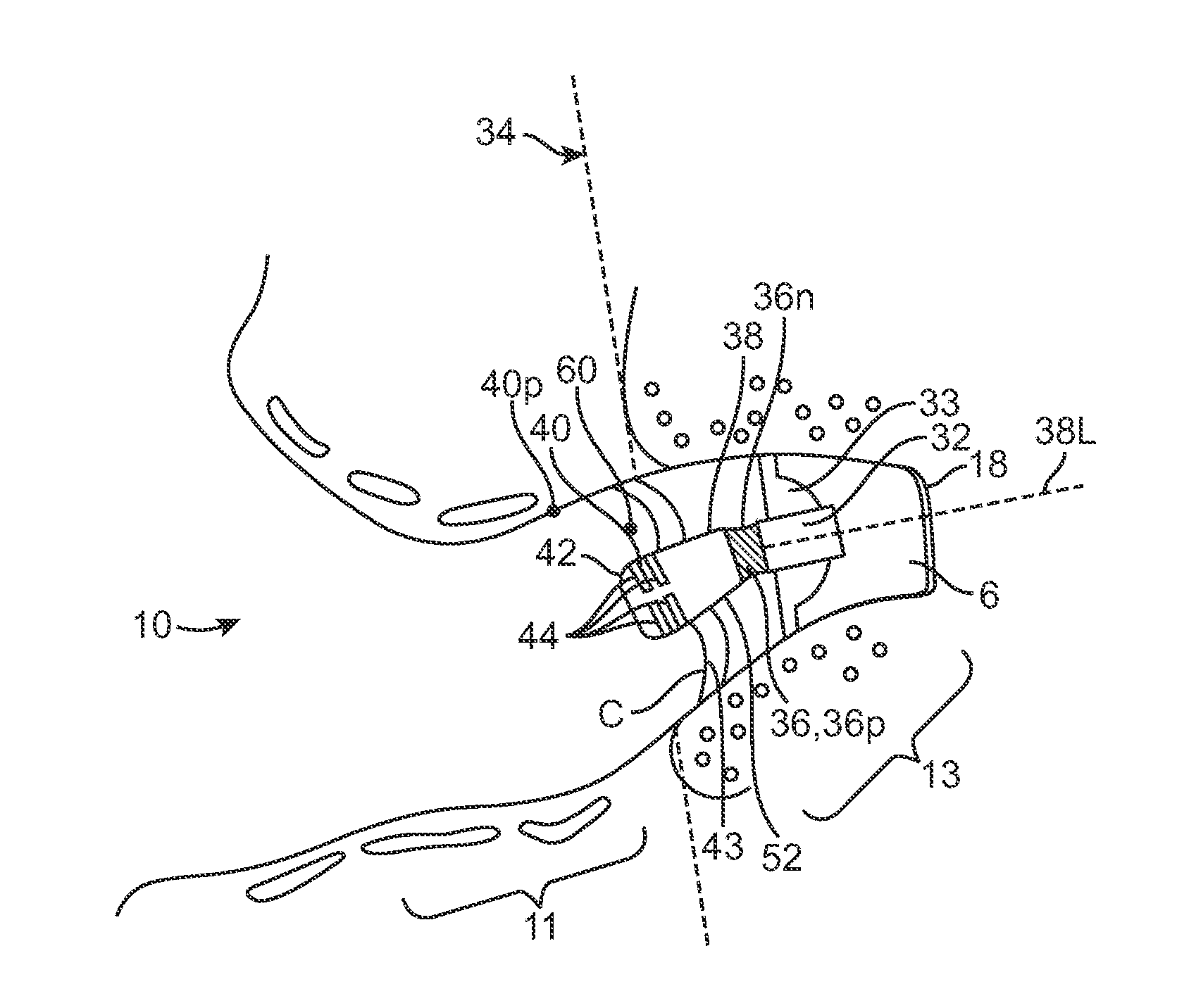 Contamination resistant ports for hearing devices