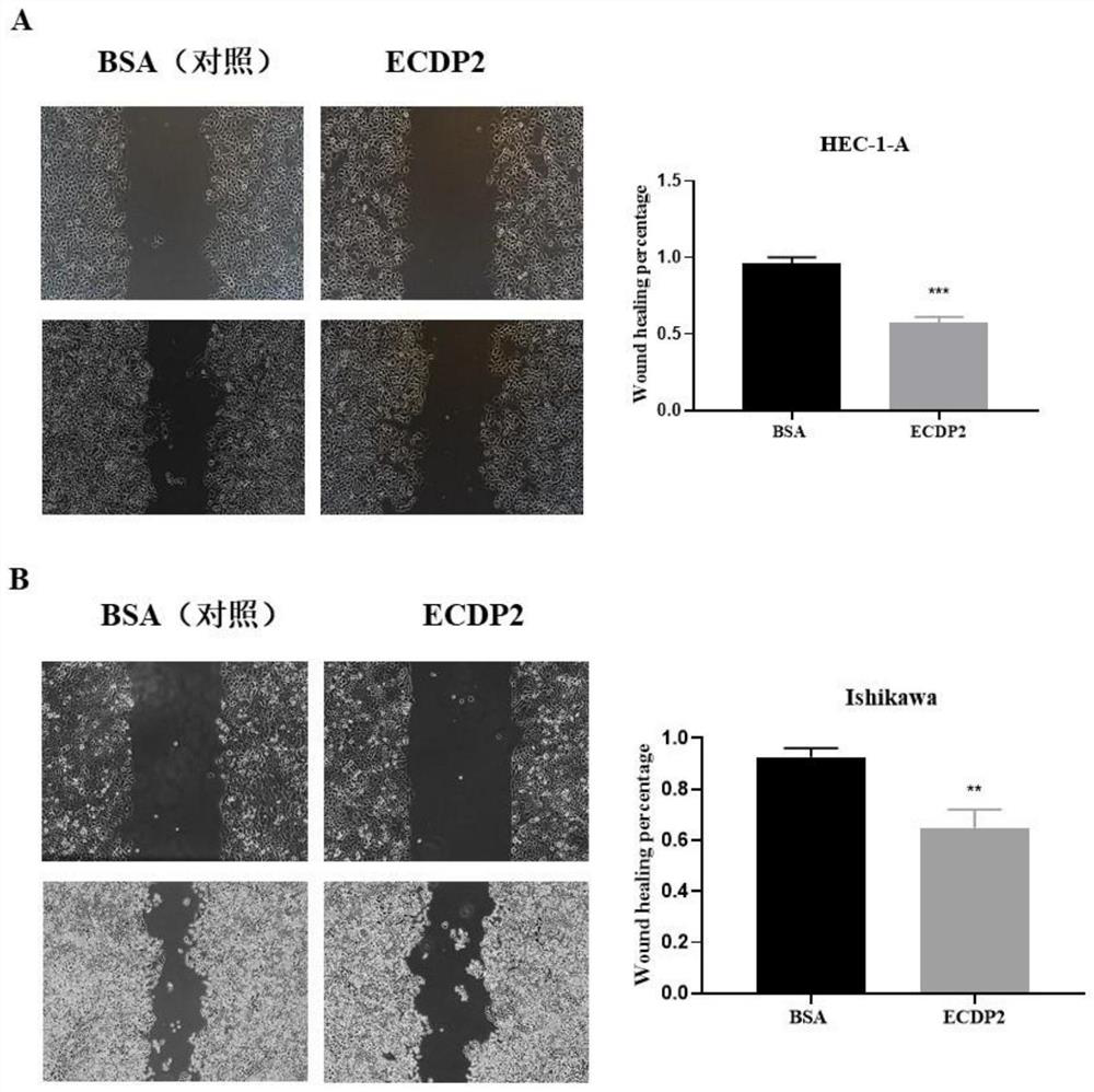 Application of endogenous polypeptide in preparation of targeted medicine for preventing or treating endometrial cancer