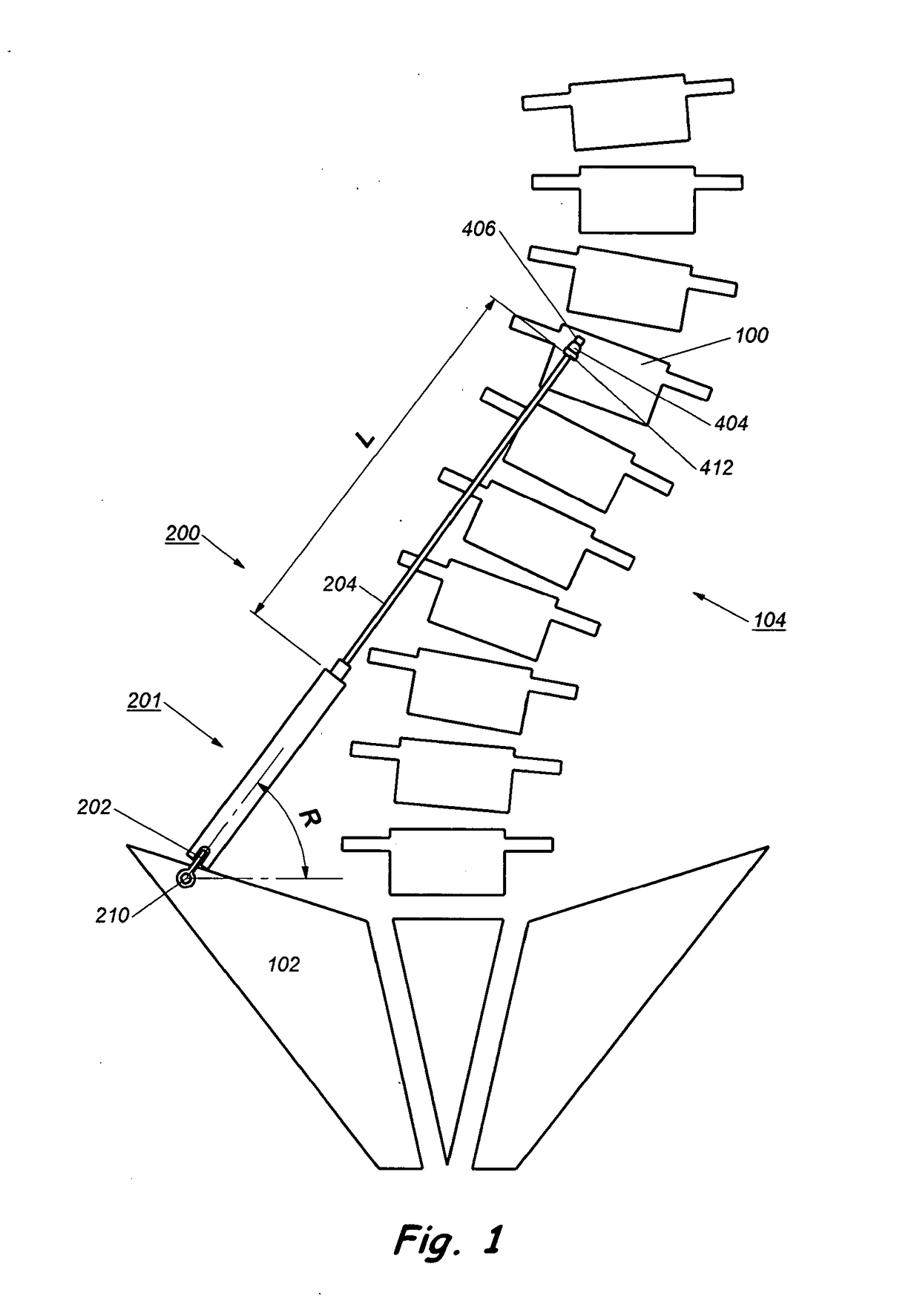 Device and method for treatment of spinal deformity