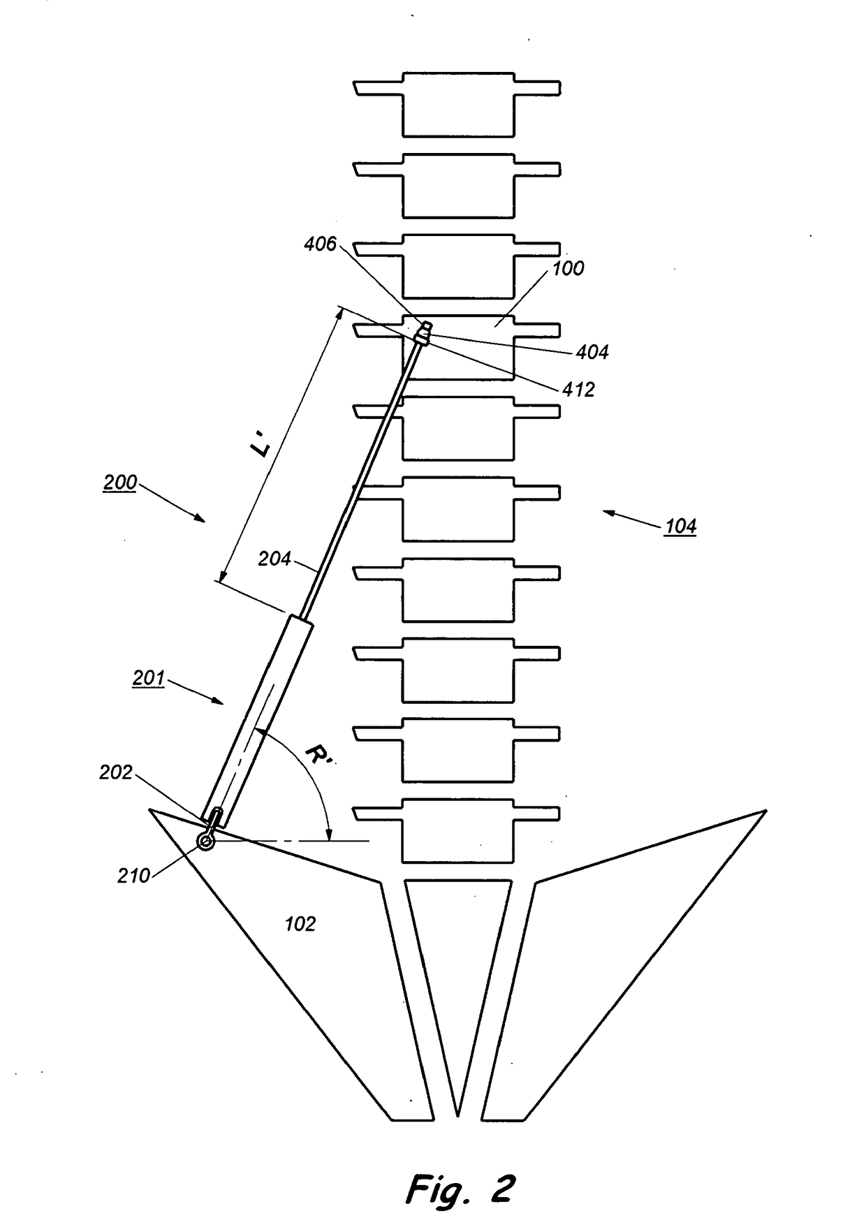 Device and method for treatment of spinal deformity