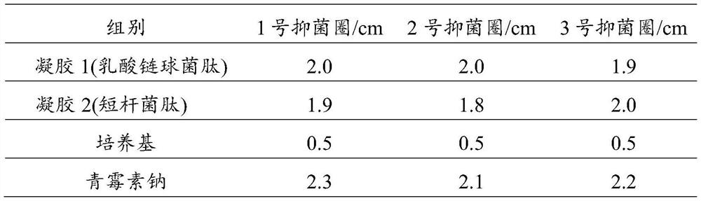 Antibacterial gel material for dental restoration, and preparation method thereof