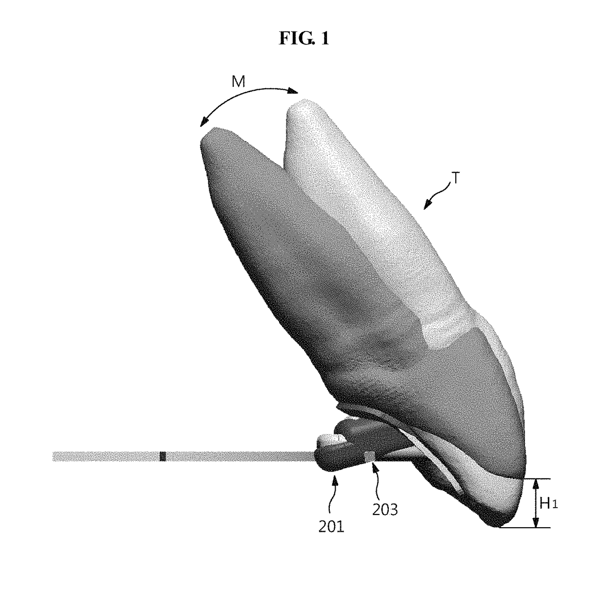 Method of fabricating custom dental correction device, and custom dental correction device fabricated by same