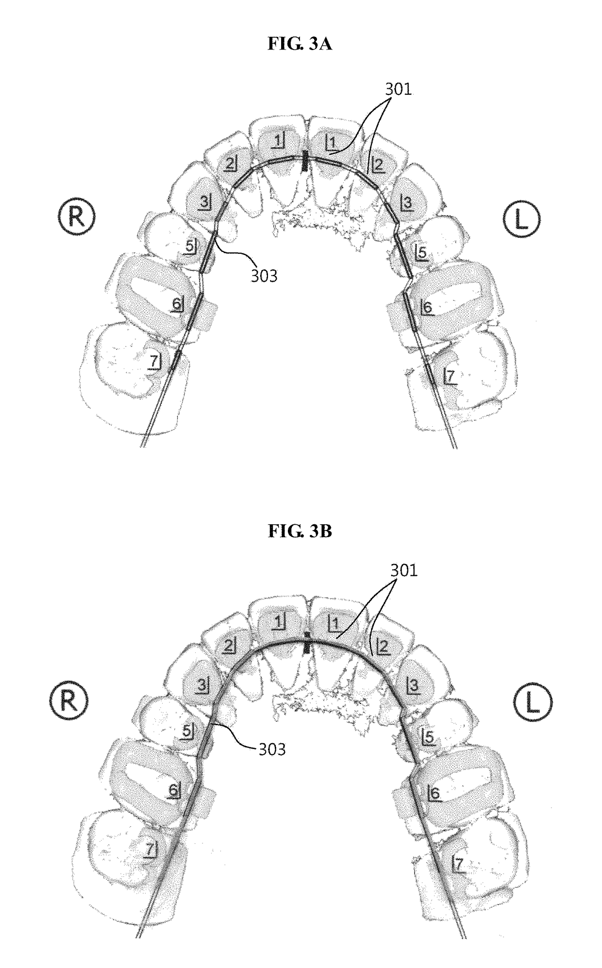 Method of fabricating custom dental correction device, and custom dental correction device fabricated by same