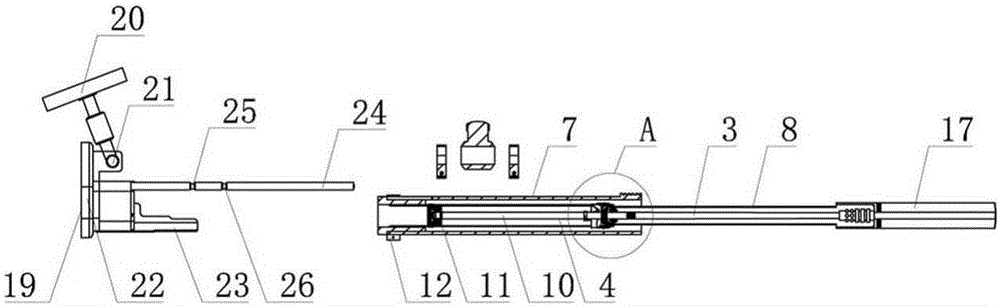 Upper urinary tract complex lesion percutaneous flexible ureteroscope operation