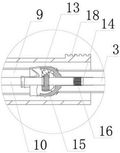 Upper urinary tract complex lesion percutaneous flexible ureteroscope operation