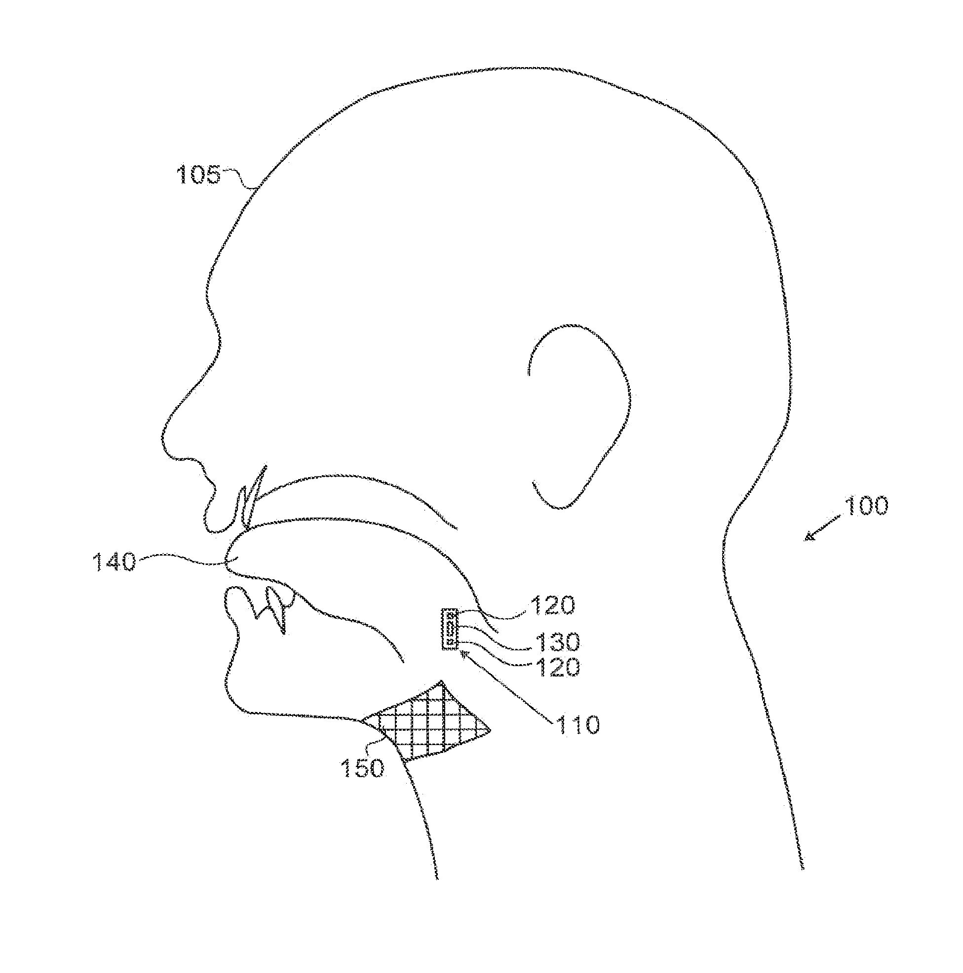 Diagnosis and Prediction of Obstructive Sleep Apnea