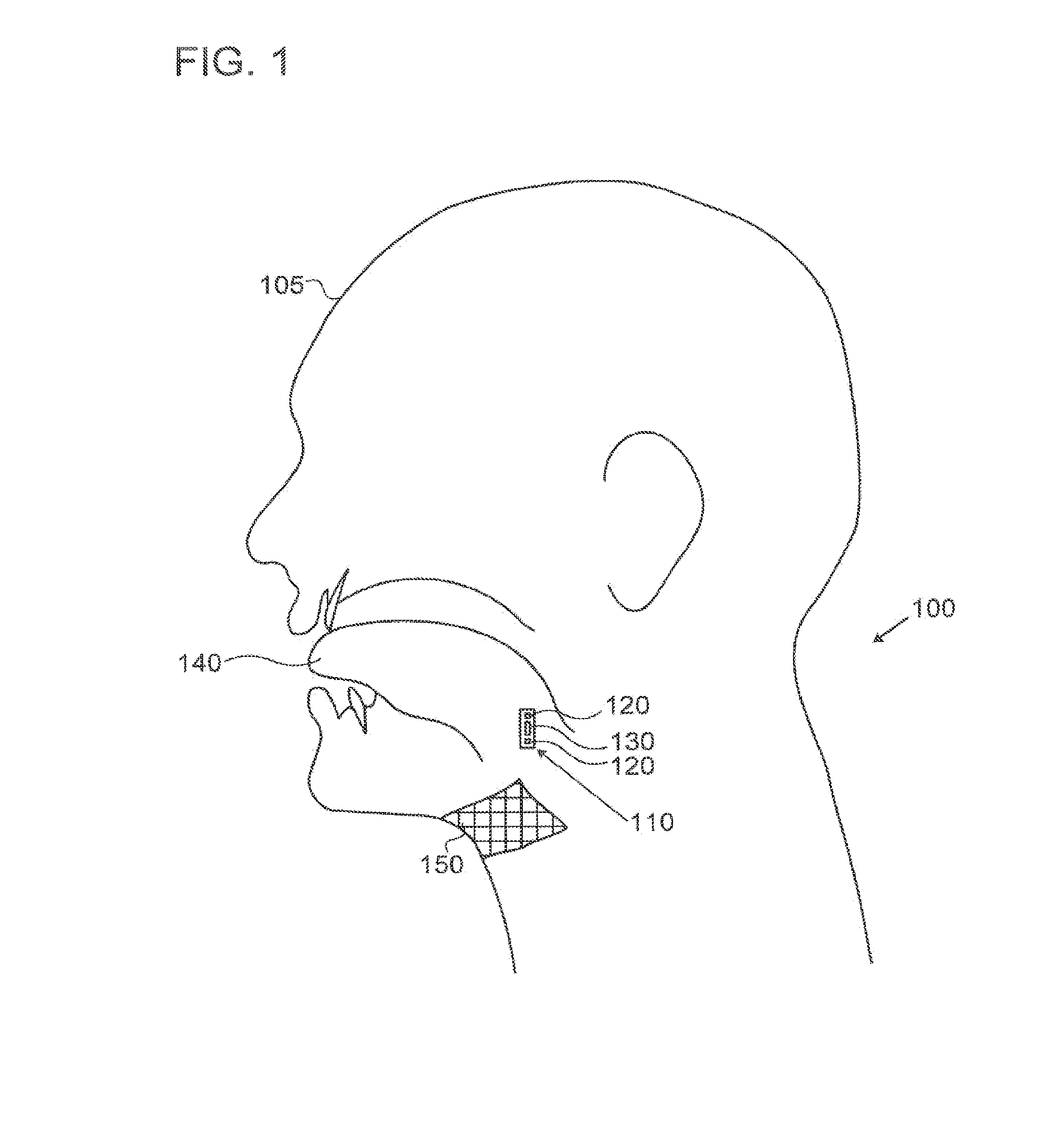 Diagnosis and Prediction of Obstructive Sleep Apnea