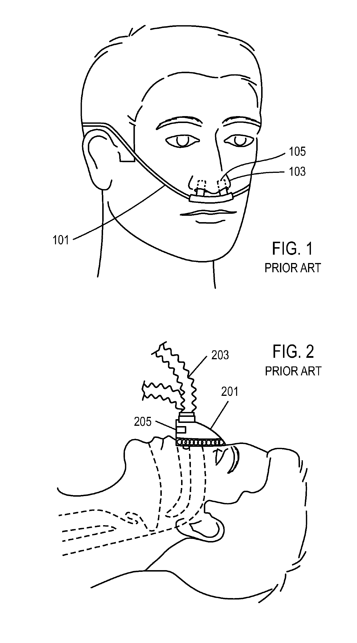 Methods, systems and devices for non-invasive ventilation including a non-sealing ventilation interface with an entrainment port and/or pressure feature