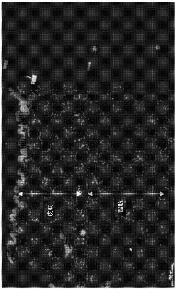 Methods, devices, and systems for improving skin characteristics