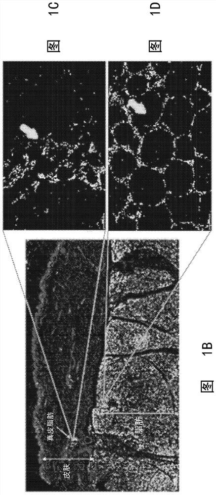 Methods, devices, and systems for improving skin characteristics