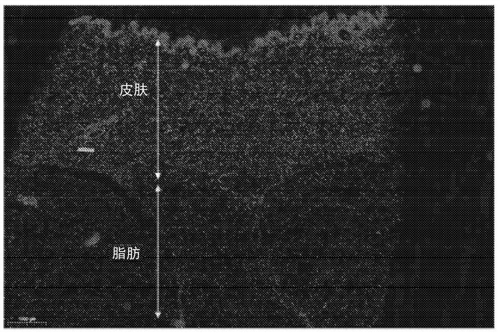 Methods, devices, and systems for improving skin characteristics