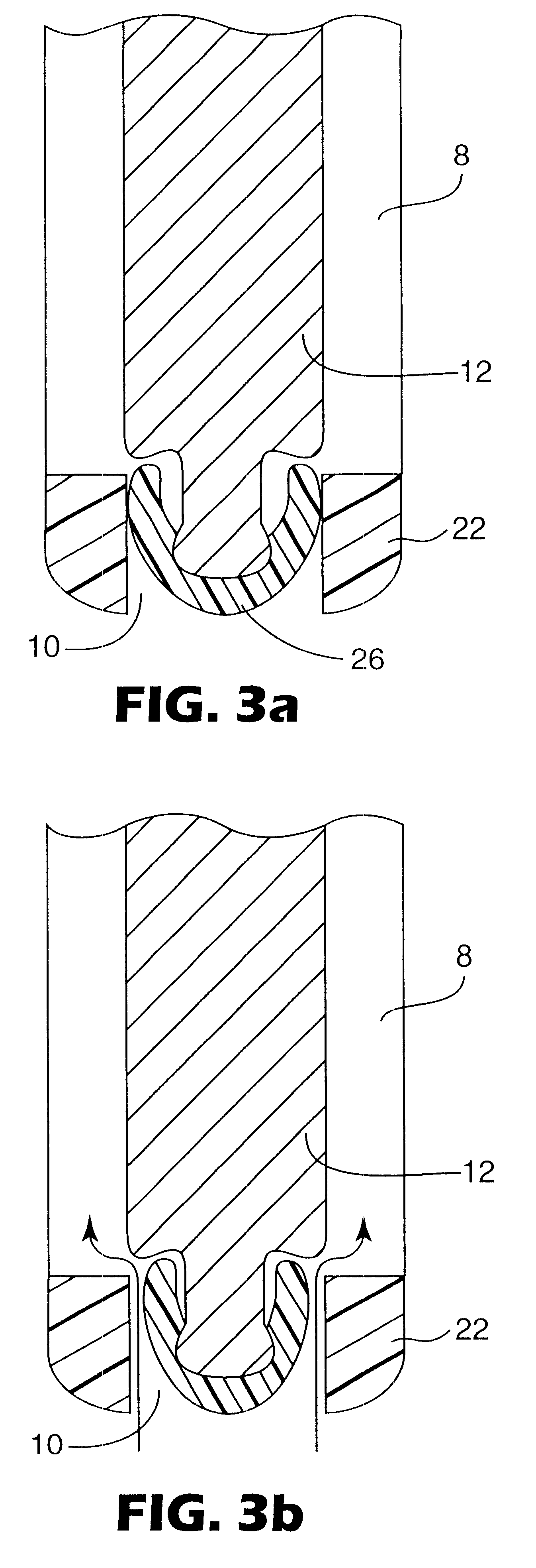 Metered dose dispensing aerosol valve