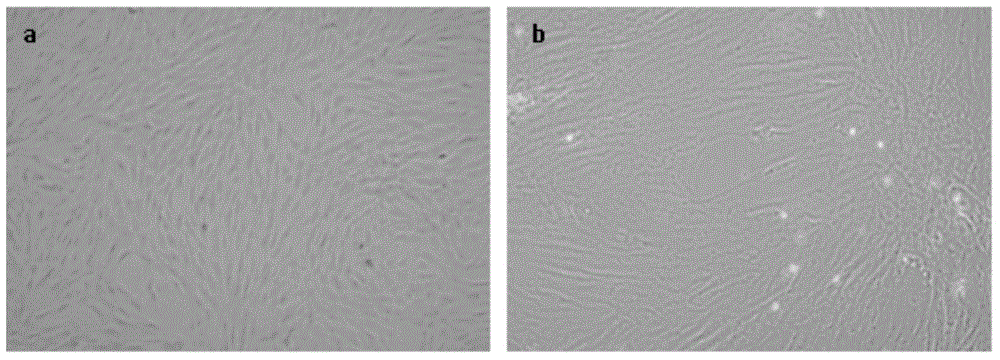 Human adipose tissue-derived stromal cell frozen stock solution