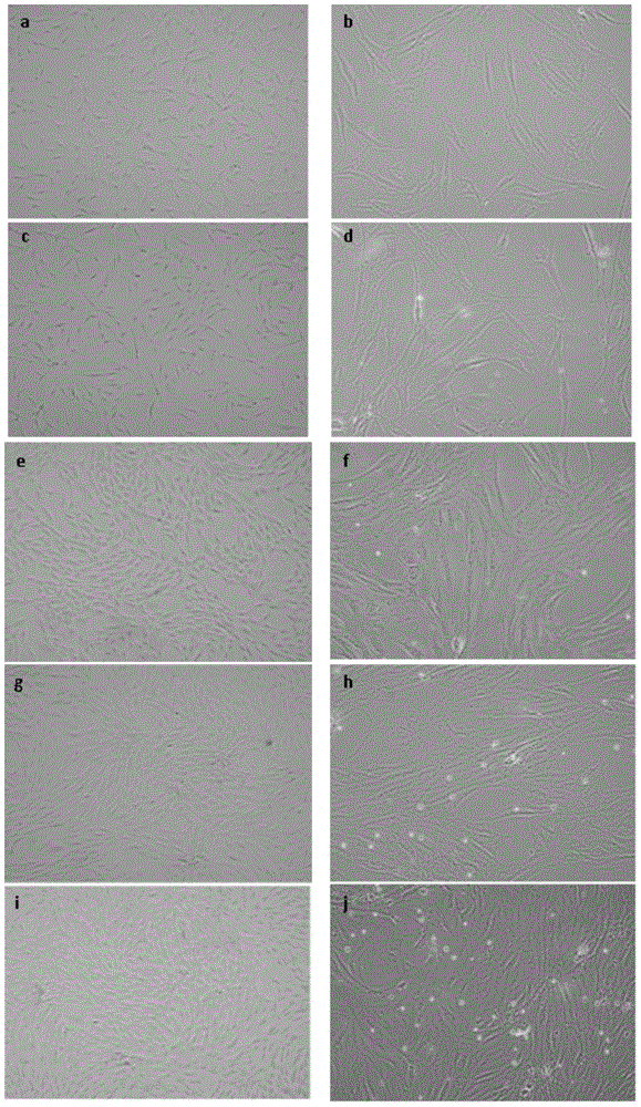 Human adipose tissue-derived stromal cell frozen stock solution