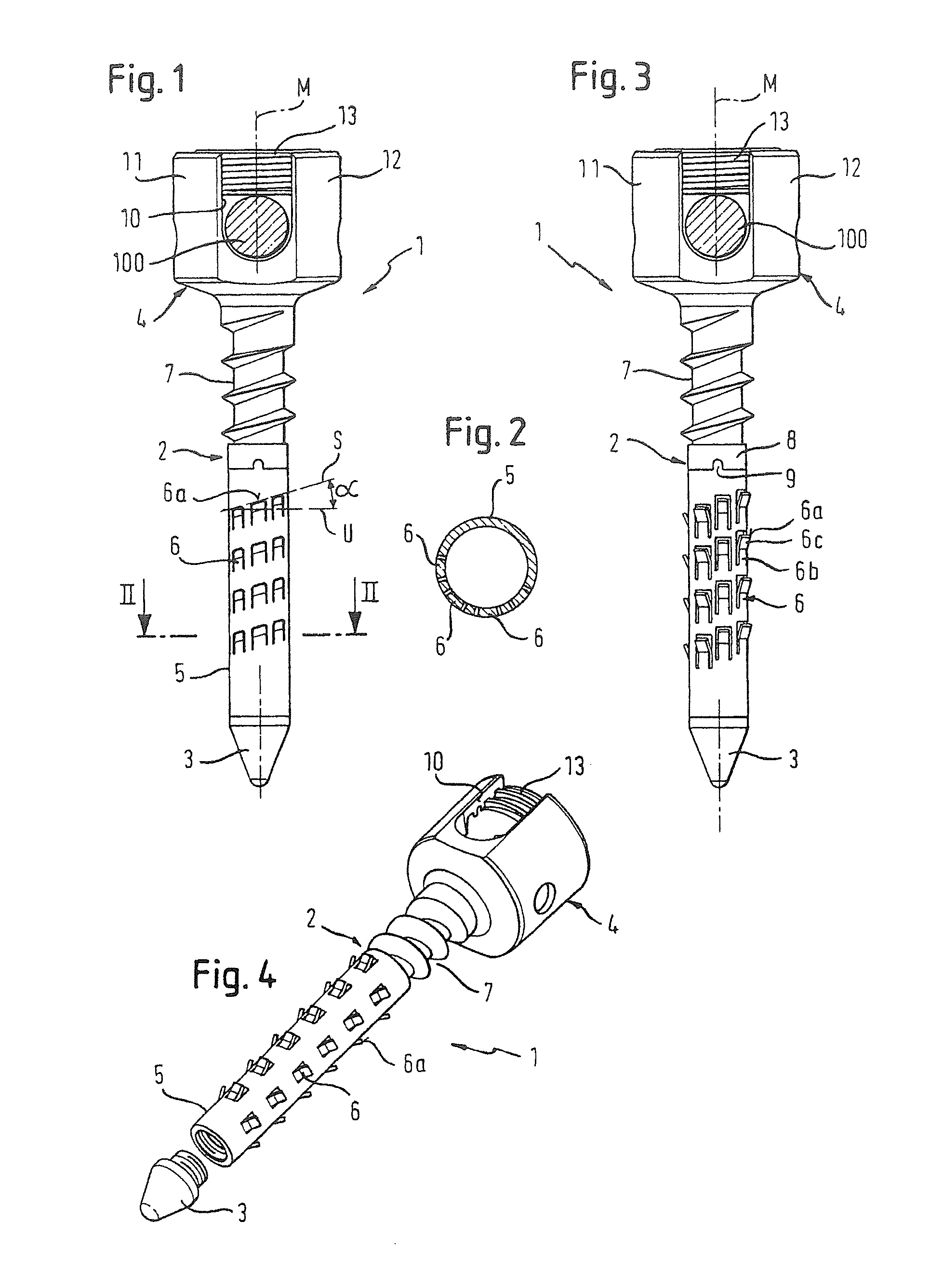 Bone anchoring device