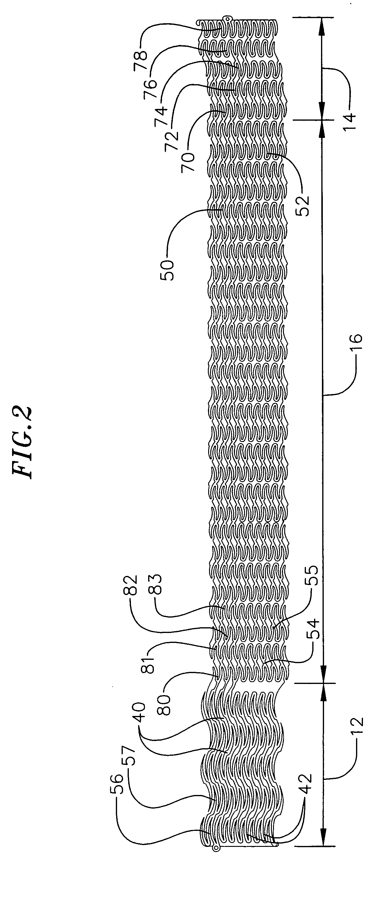 Device for changing the shape of the mitral annulus