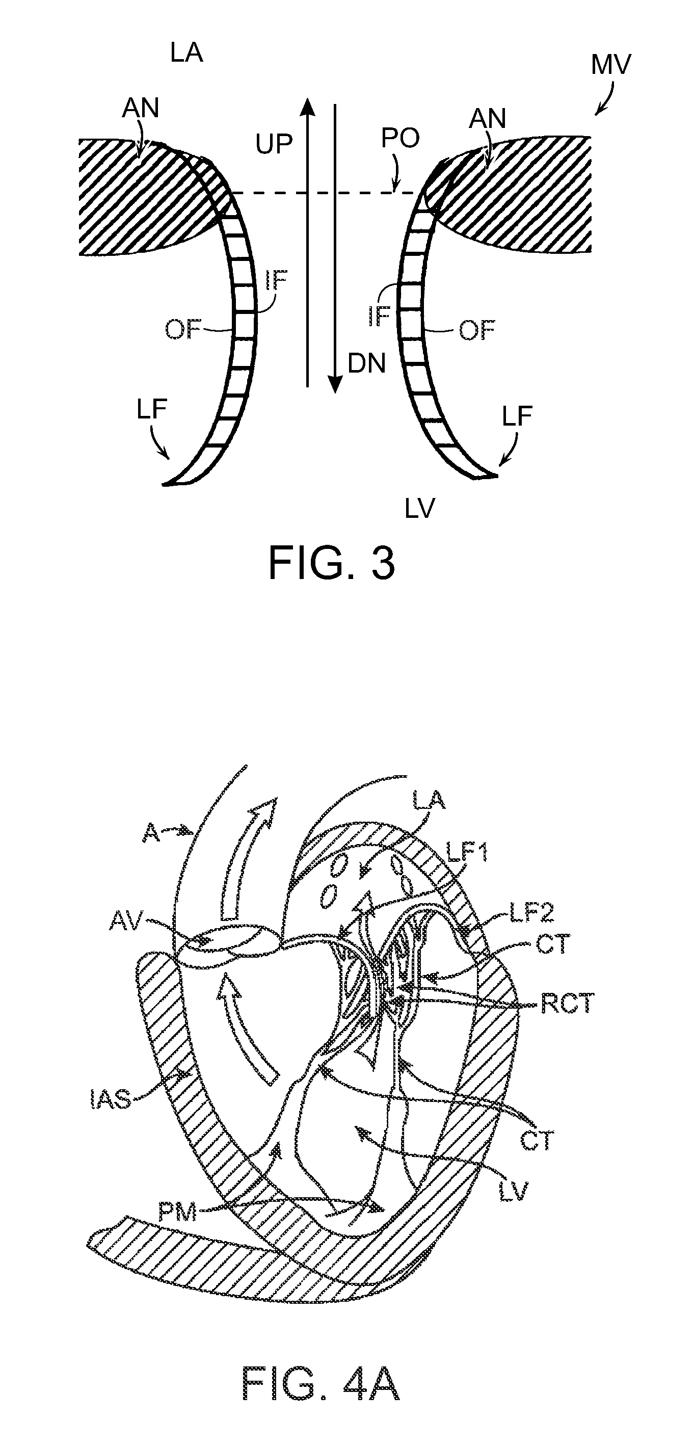 Prosthetic heart valve devices, prosthetic mitral valves and associated systems and methods