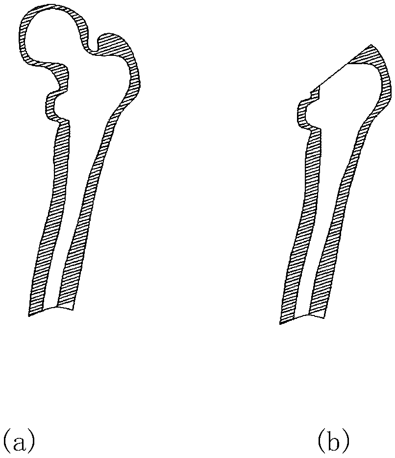 Personalized femoral stem prosthesis easy to remove and renovate and manufacturing method thereof