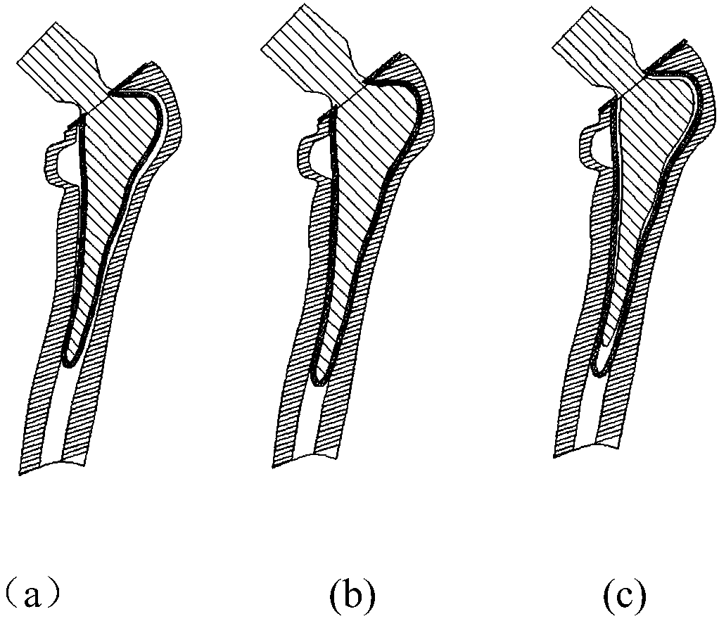 Personalized femoral stem prosthesis easy to remove and renovate and manufacturing method thereof