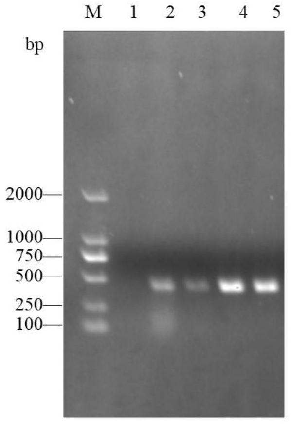 Anti-staphylococcus aureus monoclonal antibody, application and immunomagnetic beads containing same