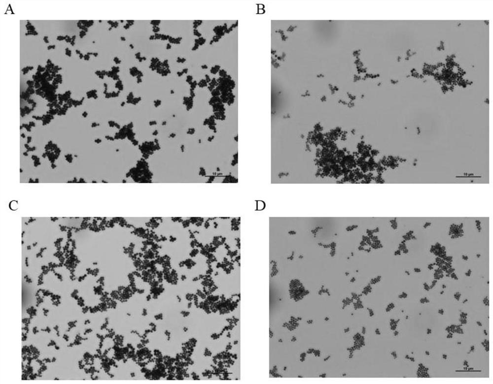 Anti-staphylococcus aureus monoclonal antibody, application and immunomagnetic beads containing same